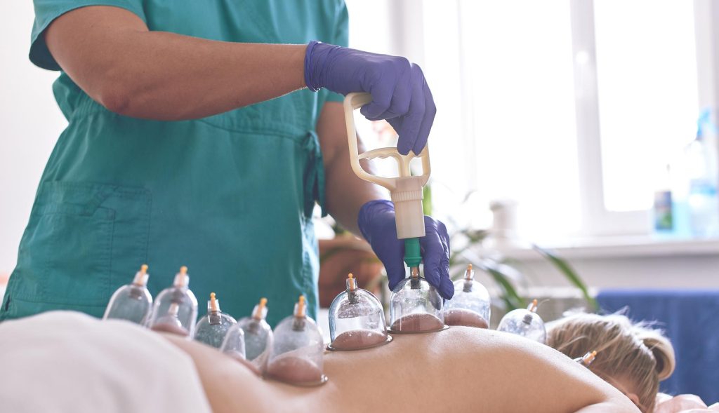 Praticien pratique une hijama sur une patiente femme